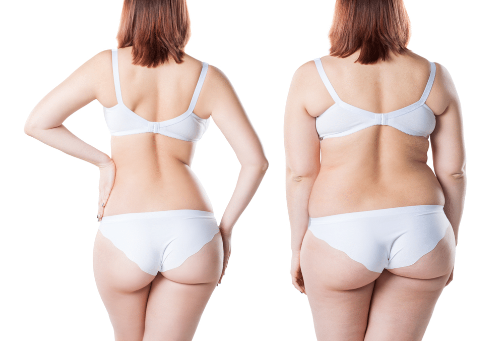 semaglutide weight loss before and after back